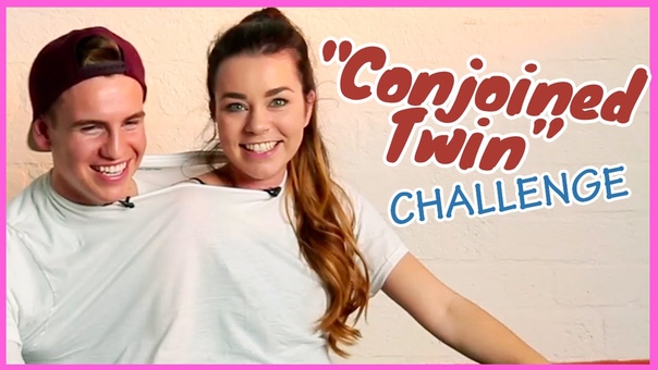 Sierra Marie Makeup and Josh Tryhane Conjoined Twin