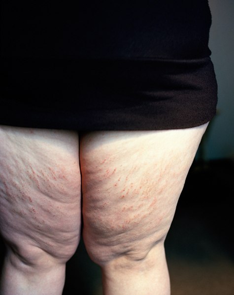 Светлана Подольская | Минск