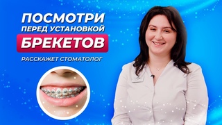 НЕ СТАВЬТЕ БРЕКЕТЫ ПОКА НЕ ПОСМОТРИТЕ ЭТО / Советы СТОМАТОЛОГА
